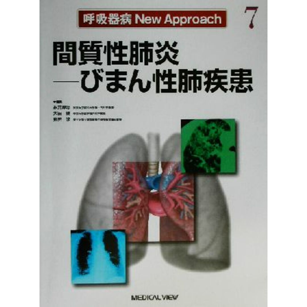 間質性肺炎 びまん性肺疾患 呼吸器病Ｎｅｗ　Ａｐｐｒｏａｃｈ７／永井厚志(編者),大田健(編者),飛田渉(編者) エンタメ/ホビーの本(健康/医学)の商品写真