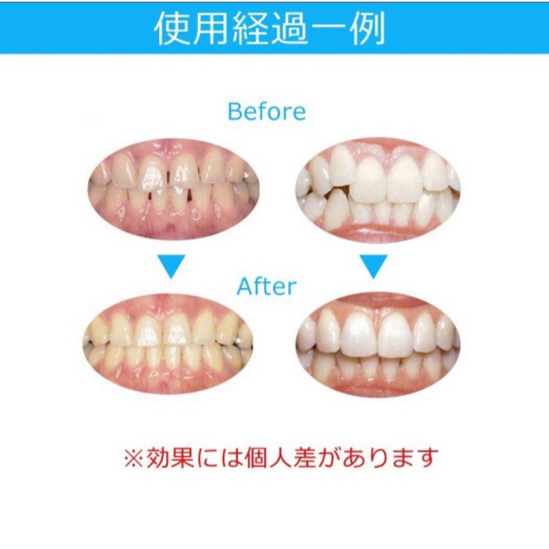 大人気◆最安値◆ マウスピース  矯正 歯ぎしり対策◆ブルー色 コスメ/美容のオーラルケア(その他)の商品写真