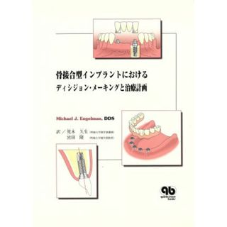 骨接合型インプラントにおけるディシジョン・メーキングと治療計画／ミカエル・Ｊ．エンゲルマン(著者),荒木久生(訳者),宮田隆(訳者)(健康/医学)