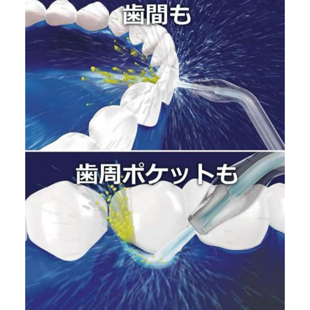 超音波水流ノズル 口腔洗浄器用 替えノズル 2本入り コスメ/美容のオーラルケア(口臭防止/エチケット用品)の商品写真