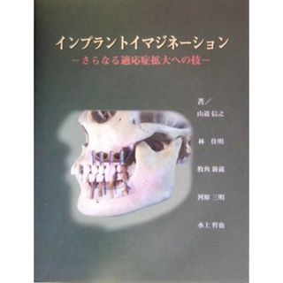 インプラントイマジネーション さらなる適応症拡大への技／山道信之，林佳明，牧角新蔵，河原三明，水上哲也【著】(健康/医学)