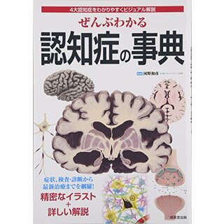 ぜんぶわかる認知症の事典: 4大認知症をわかりやすくビジュアル解説(住まい/暮らし/子育て)