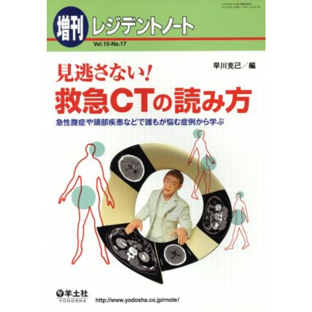 見逃さない！救急ＣＴの読み方 急性腹症や頭部疾患などで誰もが悩む症例から学ぶ／早川克己(編者) エンタメ/ホビーの本(健康/医学)の商品写真