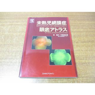 ▲01)【同梱不可】未熟児網膜症眼底アトラス/東範行/平岡美依奈/エルゼビア・ジャパン/2009年発行/A