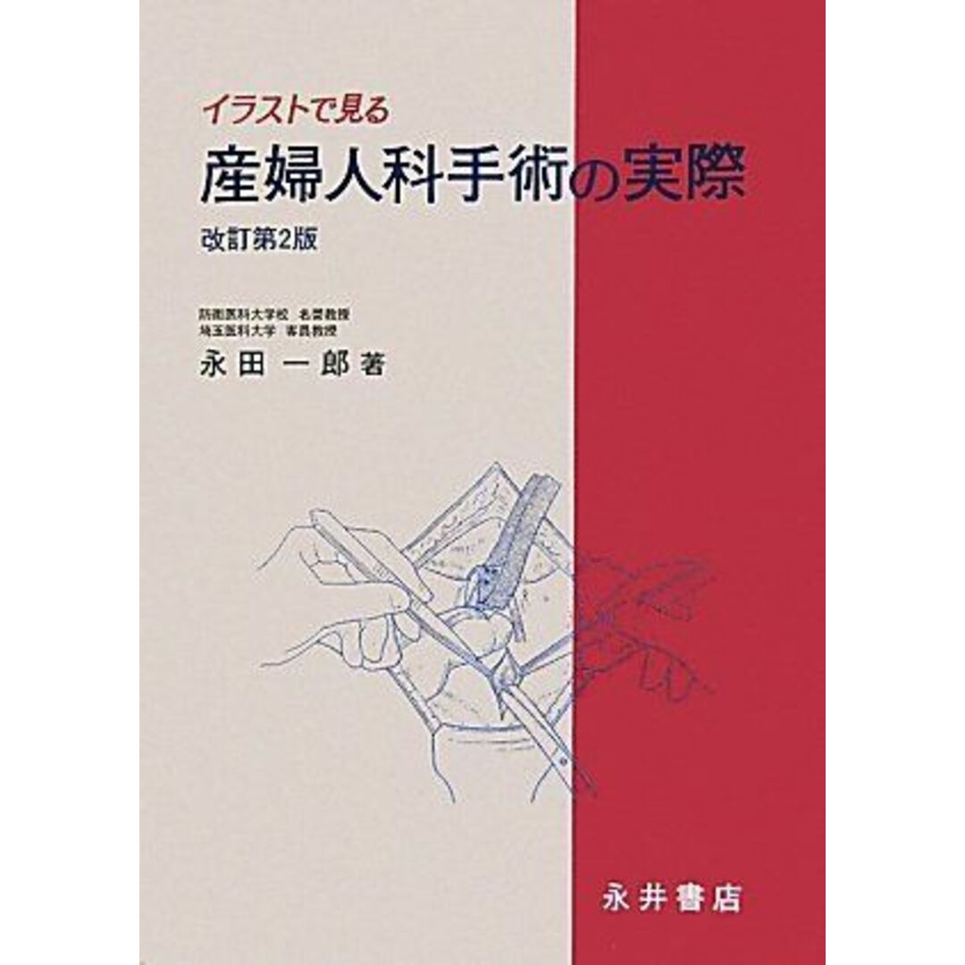 イラストで見る産婦人科手術の実際 改訂第2版 永田 一郎