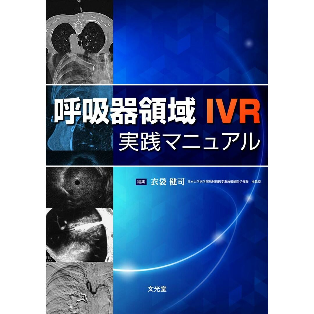 呼吸器領域IVR実践マニュアル 衣袋健司 エンタメ/ホビーの本(語学/参考書)の商品写真