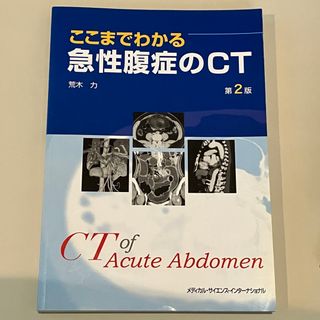 ここまでわかる急性腹症のＣＴ(健康/医学)