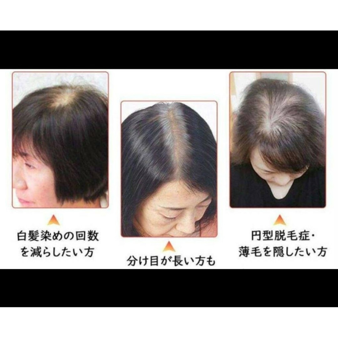 人毛100%前髪付き部分ウィッグ瞬間カバーI型つむじ地肌総 人毛100%前髪付き部分ウィッグ瞬間カバーI型つむじ地肌総