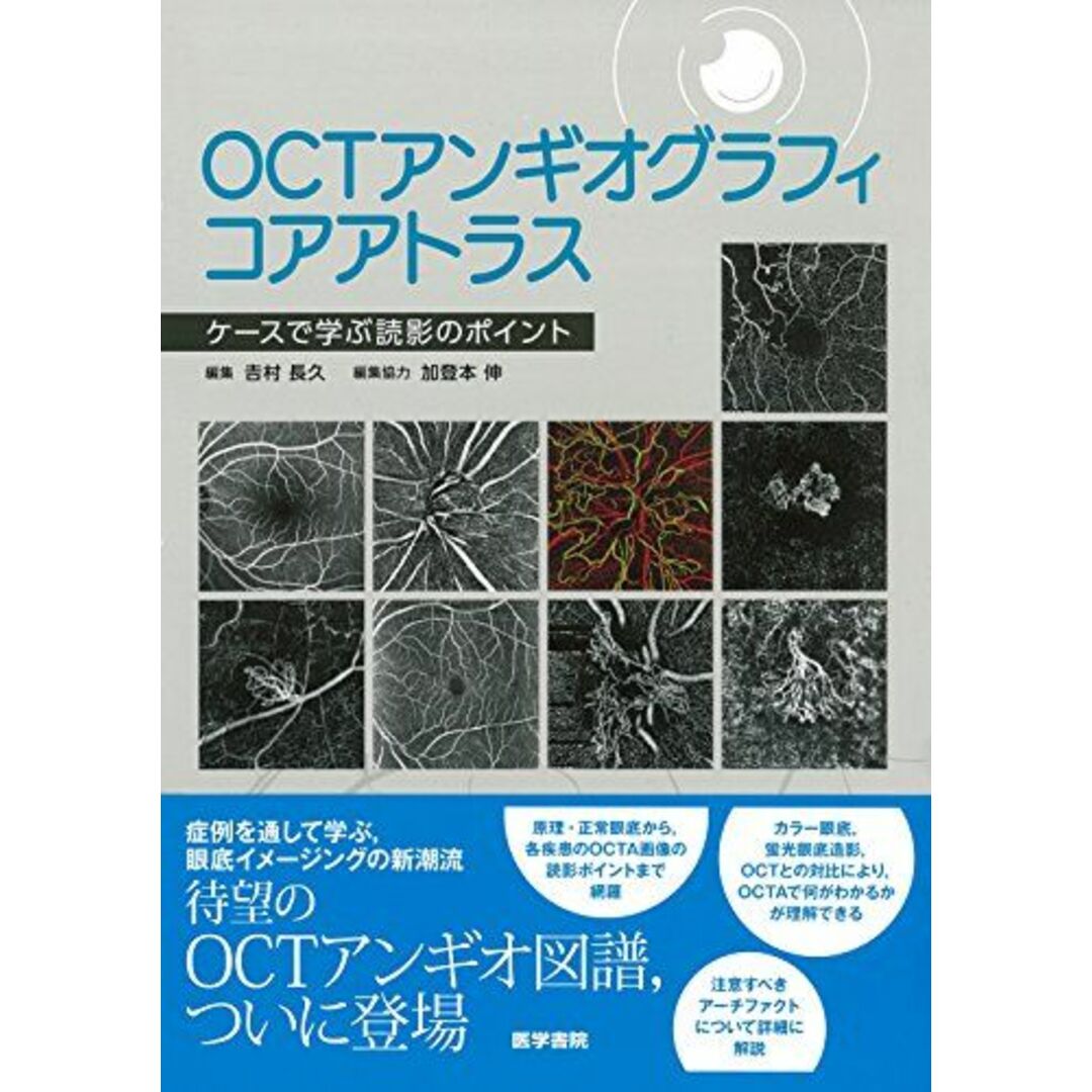 OCTアンギオグラフィコアアトラス: ケースで学ぶ読影のポイント 吉村 長久 エンタメ/ホビーの本(語学/参考書)の商品写真