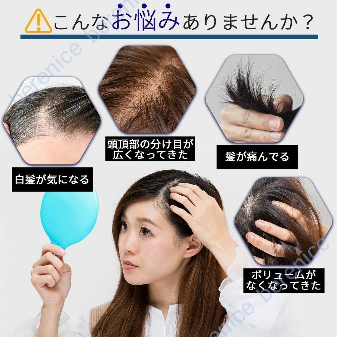 ❤ 人毛100% ヘアピース 広範囲 12×13 人工肌 部分ウイッグ 茶 ❤ ❤ 人毛100% ヘアピース 広範囲 12×13 人工肌 部分ウイッグ 茶 ❤