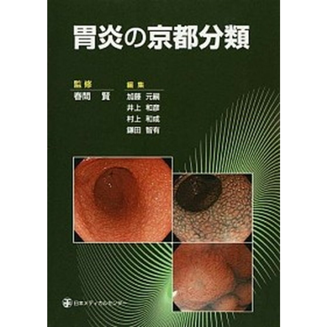 胃炎の京都分類 /日本メディカルセンタ-/加藤元嗣(単行本) エンタメ/ホビーの本(健康/医学)の商品写真