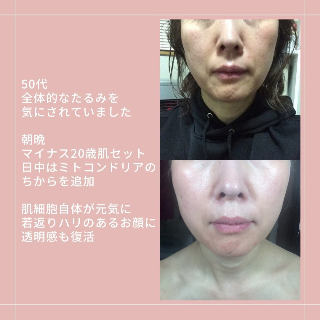 アキノリオ Newマイナス20歳肌セット ミトコンドリアのちから、ハーブのちから アキノリオ Newマイナス20歳肌セット ミトコンドリアのちから、ハーブのちから
