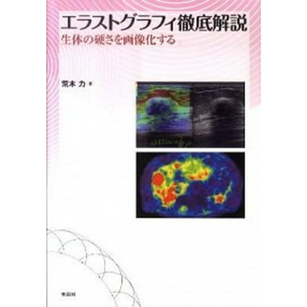 ≪超目玉★12月≫ エラストグラフィ徹底解説 生体の硬さを画像化する /学研 医学一般