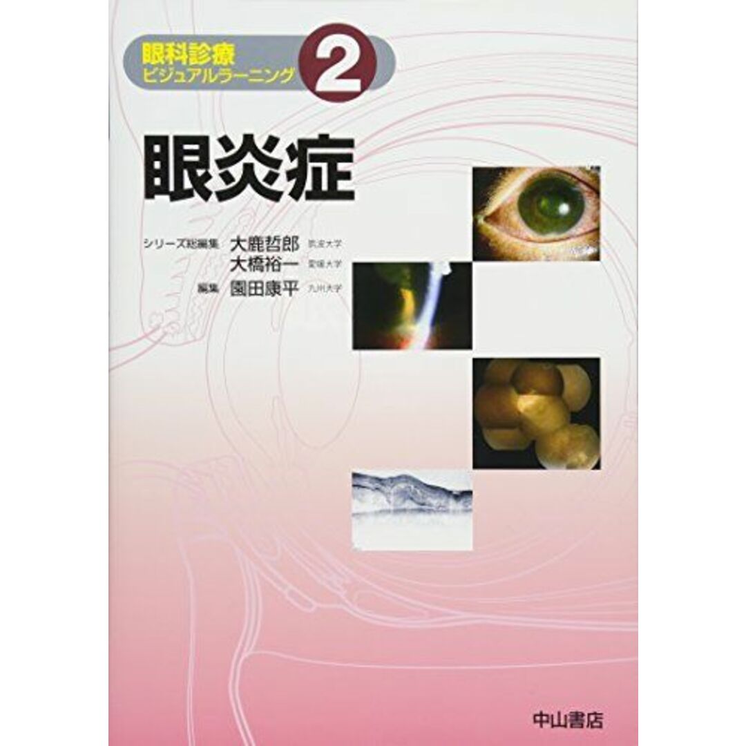 眼炎症 (眼科診療ビジュアルラーニング) エンタメ/ホビーの本(語学/参考書)の商品写真
