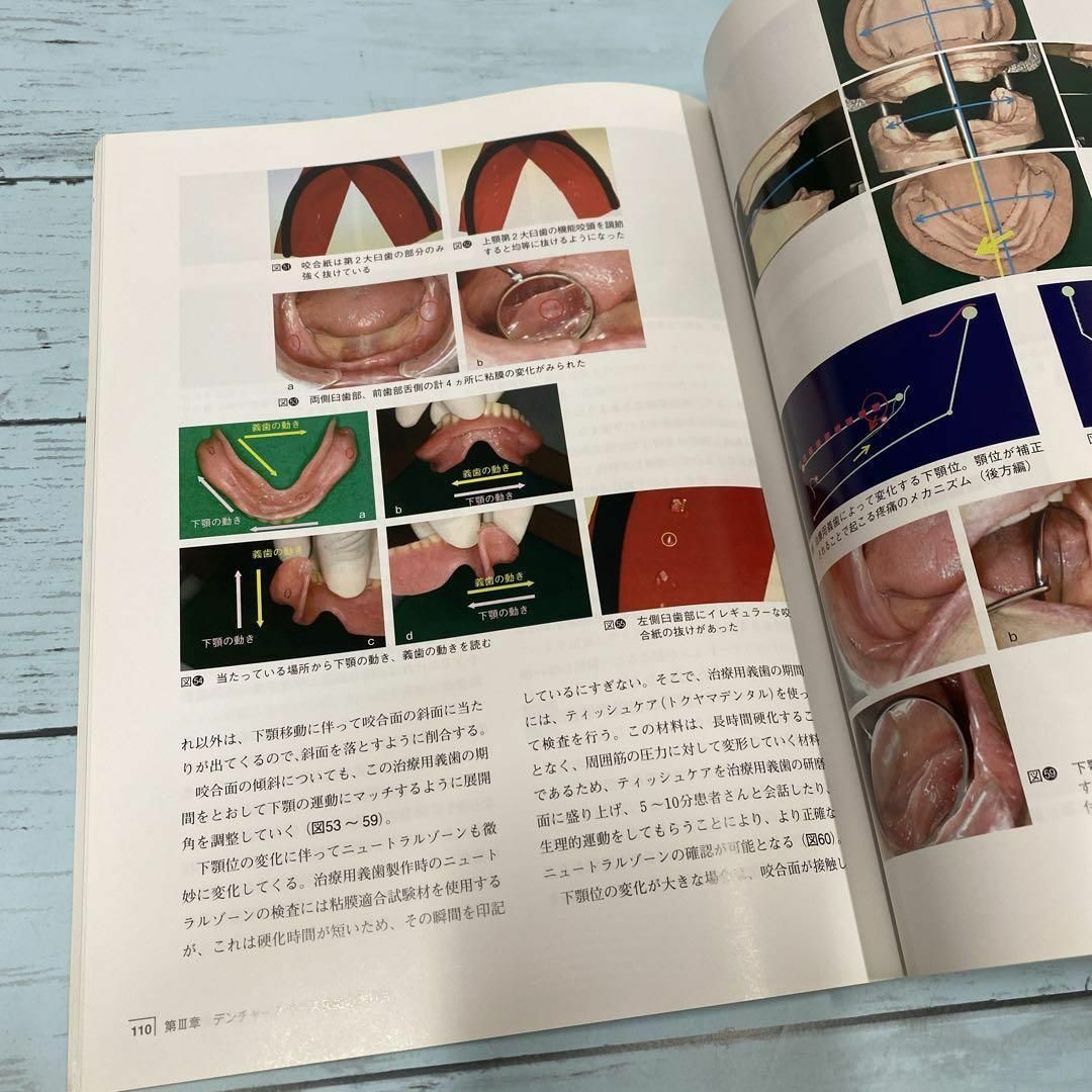 当店の記念日 総義歯難症例への対応その理論と実際 デンタルダイヤモンド社 歯科学