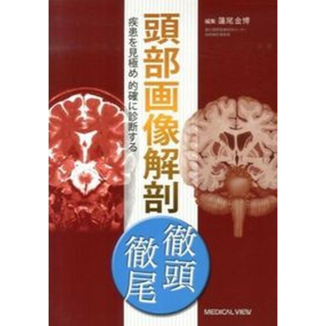 頭部画像解剖徹頭徹尾 疾患を見極め的確に診断する 頭部画像解剖徹頭徹尾 疾患を見極め的確に診断する