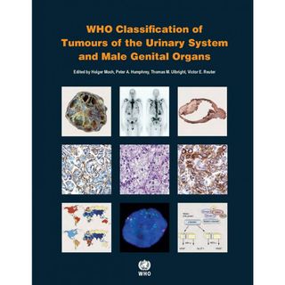 WHO Classification of Tumours of the Urinary System and Male Genital Organs (World Health Organization Classification of Tumours) Moch， Holger? Humphrey， Peter A.? Ulbright， Thomas M.; Reuter， Victor (語学/参考書)