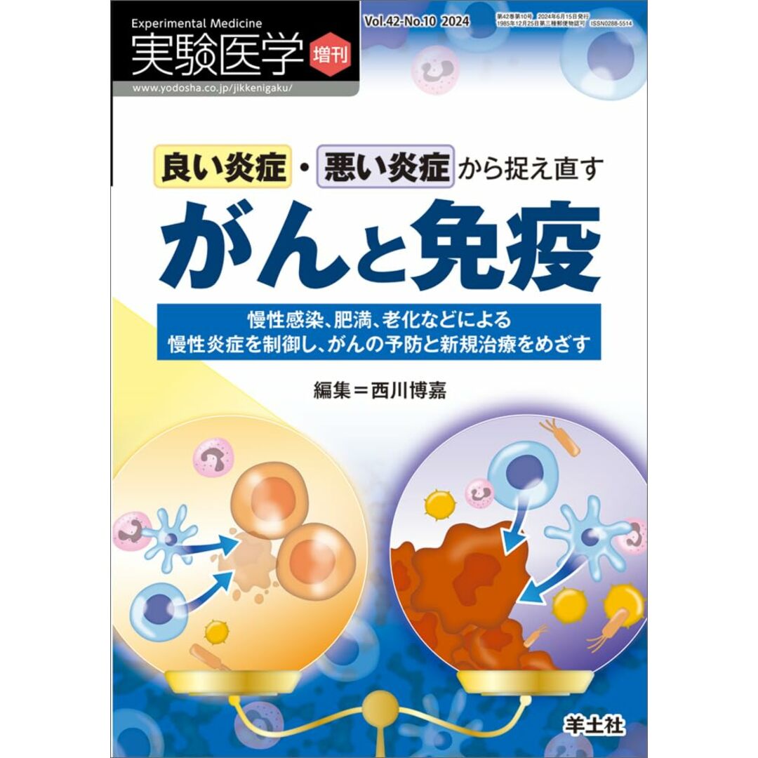 実験医学増刊 Vol.42 No.10 良い炎症・悪い炎症から捉え直すがんと免疫?慢性感染、肥満、老化などによる慢性炎症を制御し、がんの予防と新規治療をめざす エンタメ/ホビーの本(語学/参考書)の商品写真