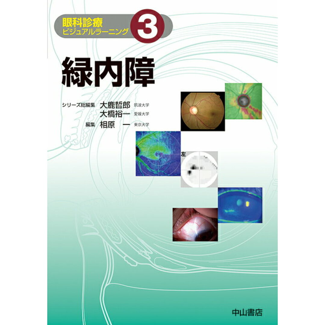 新着入荷の通販 緑内障 /中山書店/大鹿哲郎(単行本) 健康+医学