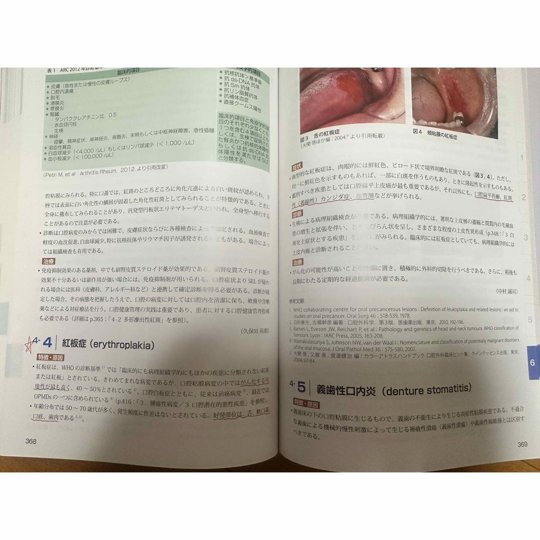 口腔内科学　第二班 エンタメ/ホビーの本(健康/医学)の商品写真