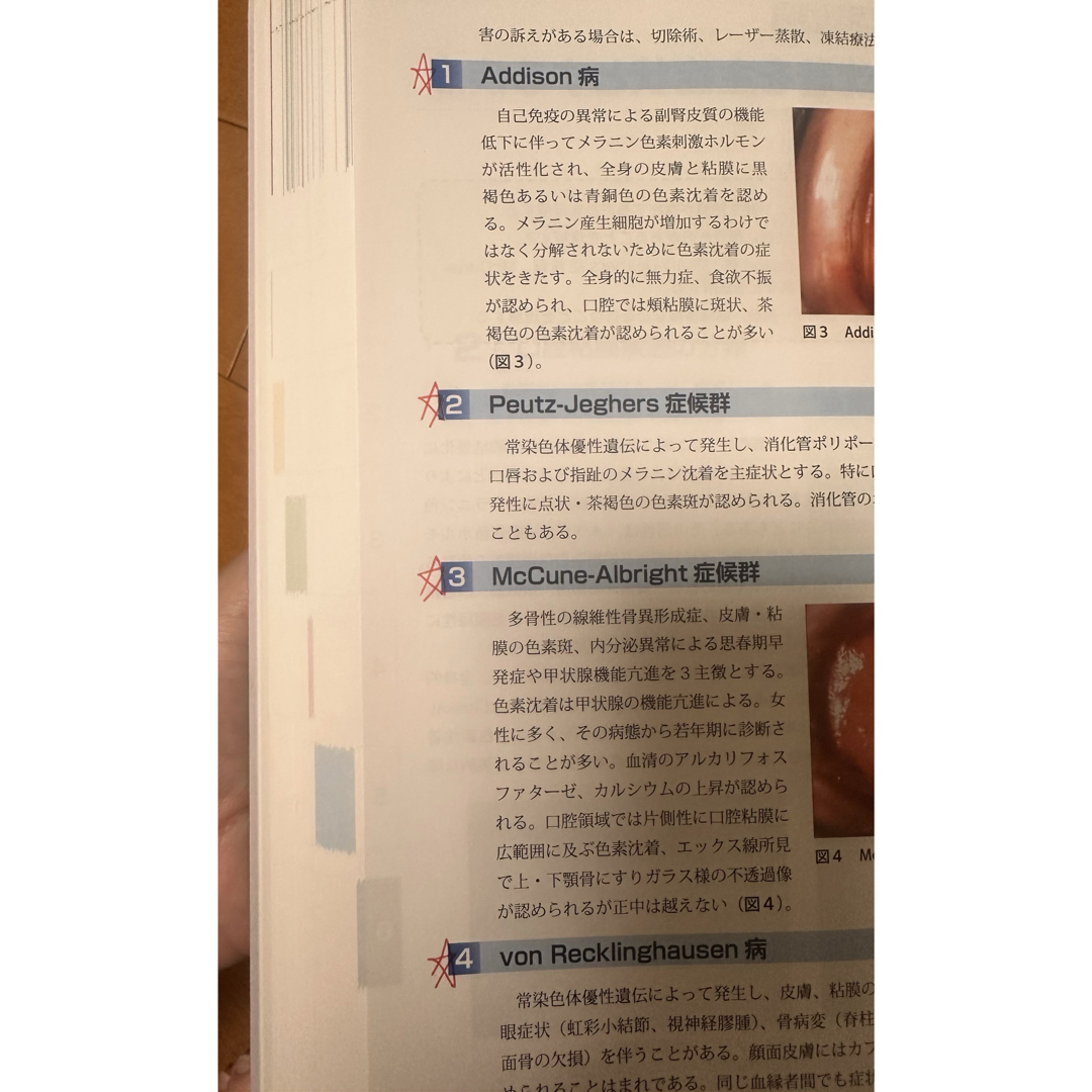 口腔内科学　第二班 エンタメ/ホビーの本(健康/医学)の商品写真
