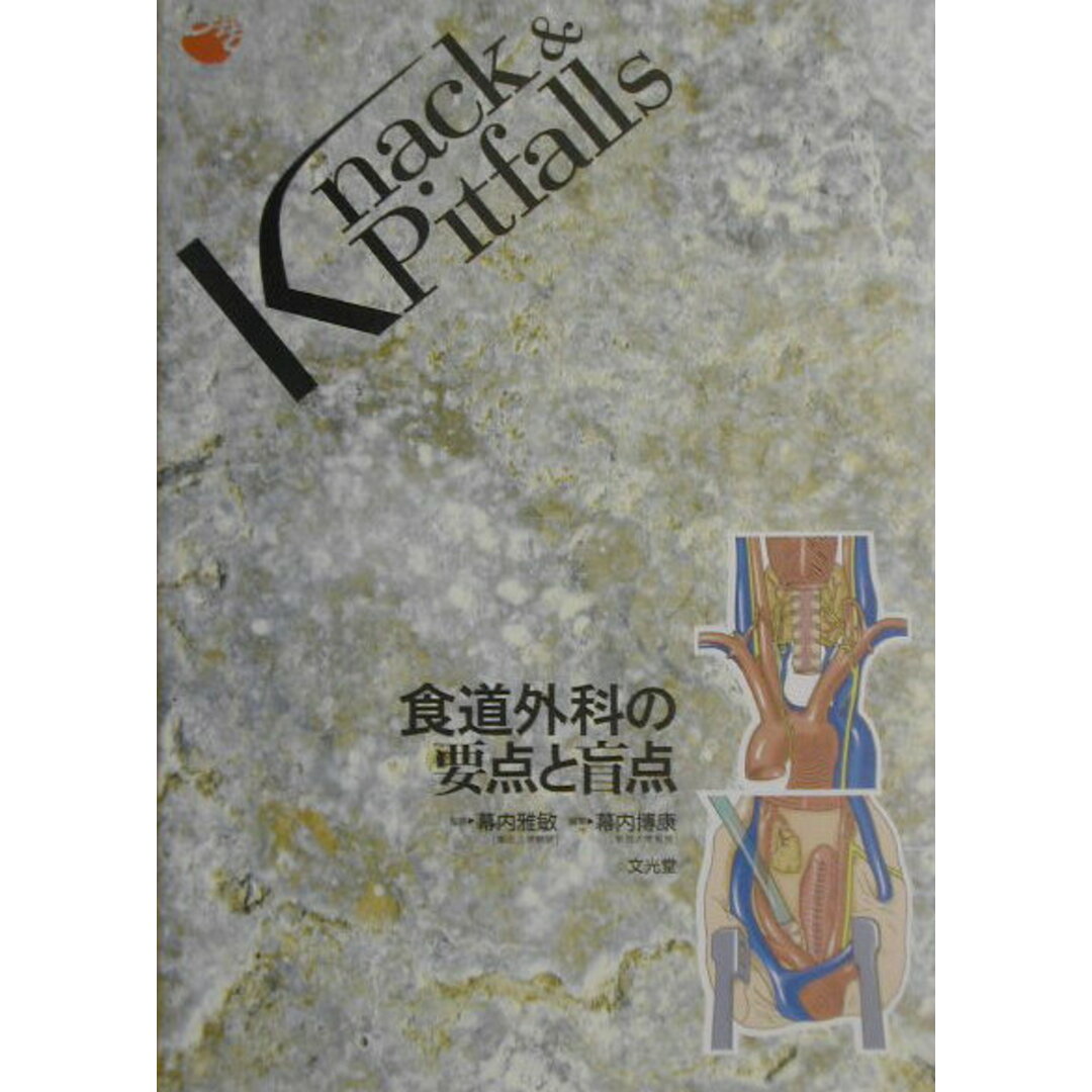 食道外科の要点と盲点 /文光堂/幕内博康(単行本) エンタメ/ホビーの本(健康/医学)の商品写真