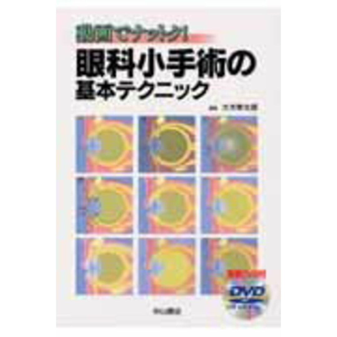 眼科小手術の基本テクニック 動画でナットク!/中山書店/大木孝太郎(単行本) エンタメ/ホビーの本(健康/医学)の商品写真