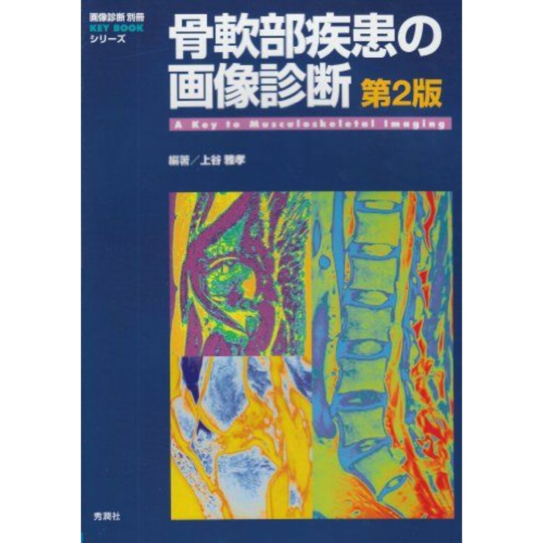 骨軟部疾患の画像診断 第2版 (画像診断別冊KEY BOOKシリーズ) エンタメ/ホビーの本(語学/参考書)の商品写真