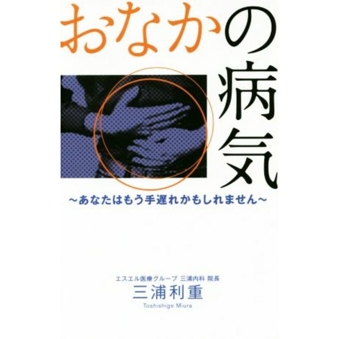 おなかの病気 あなたはもう手遅れかもしれません/三浦利重(著者) エンタメ/ホビーの本(健康/医学)の商品写真