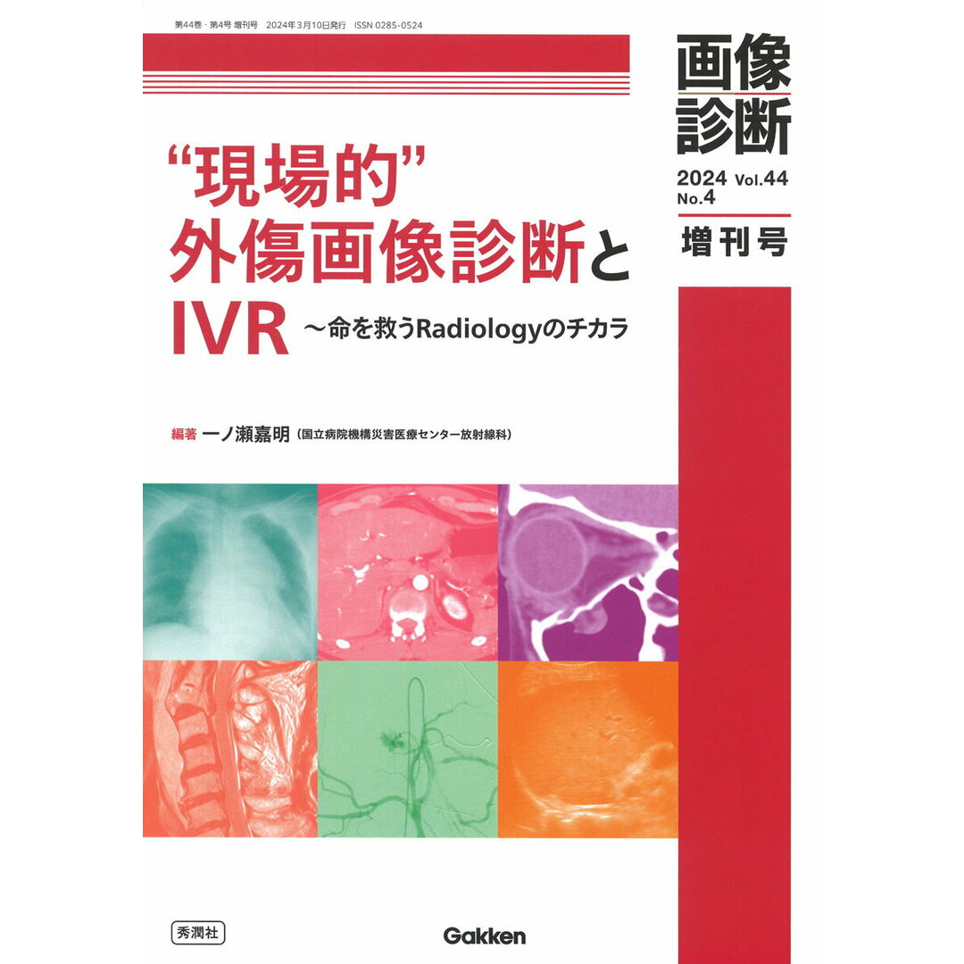 ”現場的”外傷画像診断とIVR 命を救うRadiologyのチカラ/Gakken/一ノ瀬嘉明(単行本) エンタメ/ホビーの本(健康/医学)の商品写真