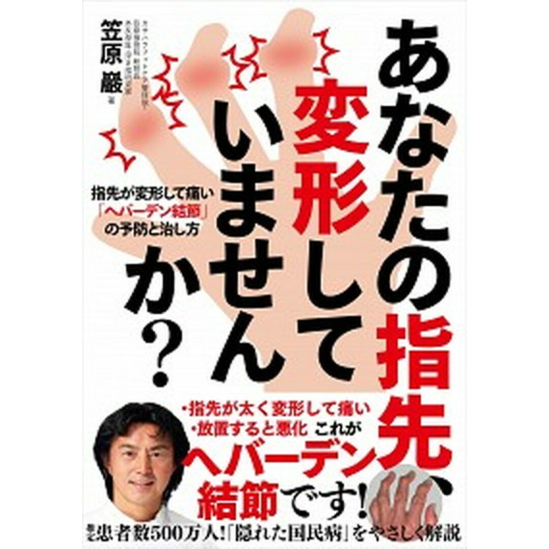 あなたの指先、変形していませんか? 指先が変形して痛い「ヘバーデン結節」の予防と治し方 /自由国民社/笠原巖(単行本(ソフトカバー)) エンタメ/ホビーの本(健康/医学)の商品写真