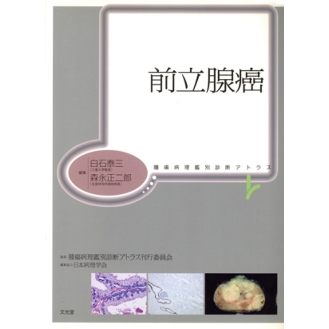 前立腺癌/白石泰三(著者),森永正二郎(著者) エンタメ/ホビーの本(健康/医学)の商品写真