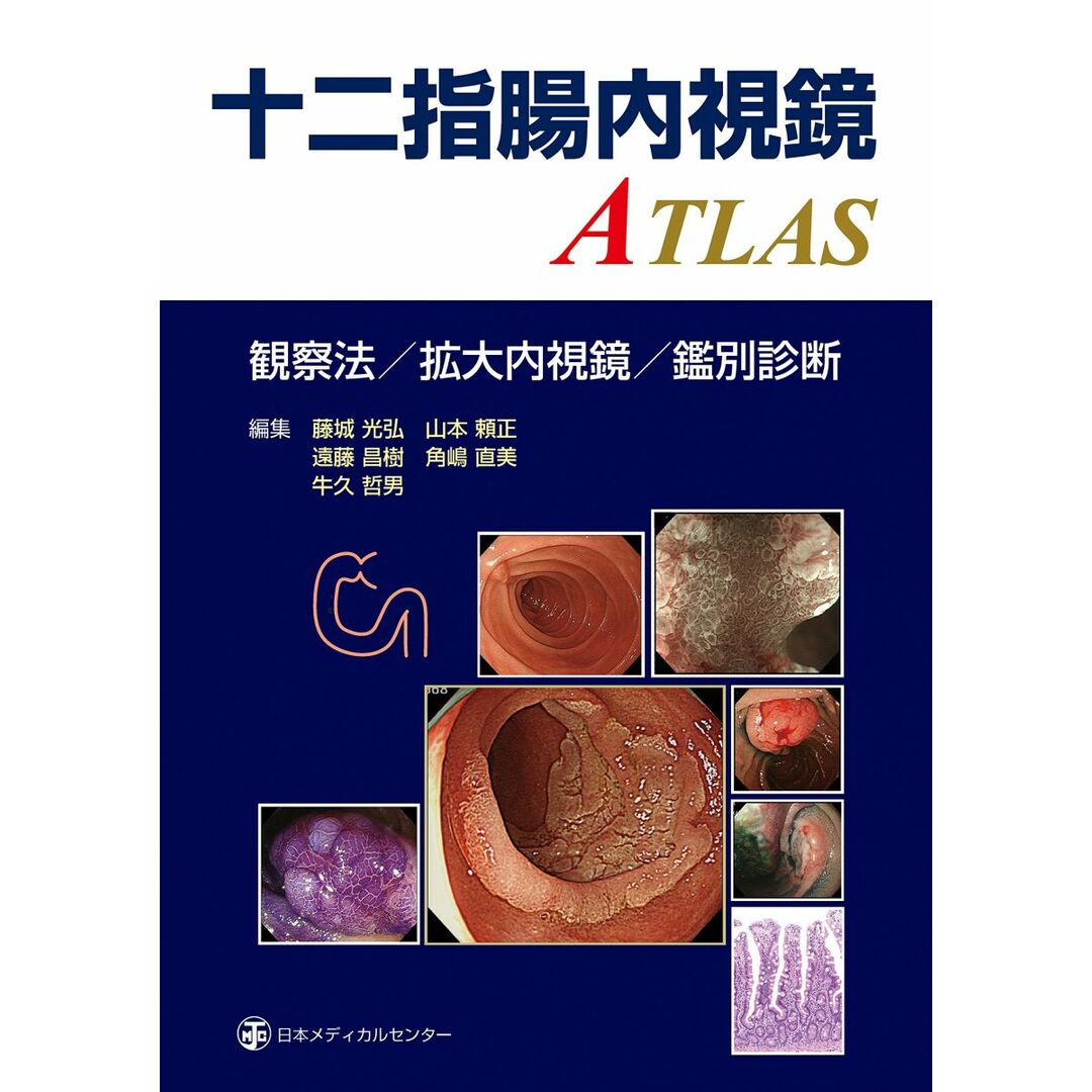 口コミ サイト 商品 十二指腸内視鏡ATLAS 哲男 牛久 直美; 角嶋 昌樹? 遠藤 頼正? 山本 光弘? 藤城 語学+参考書