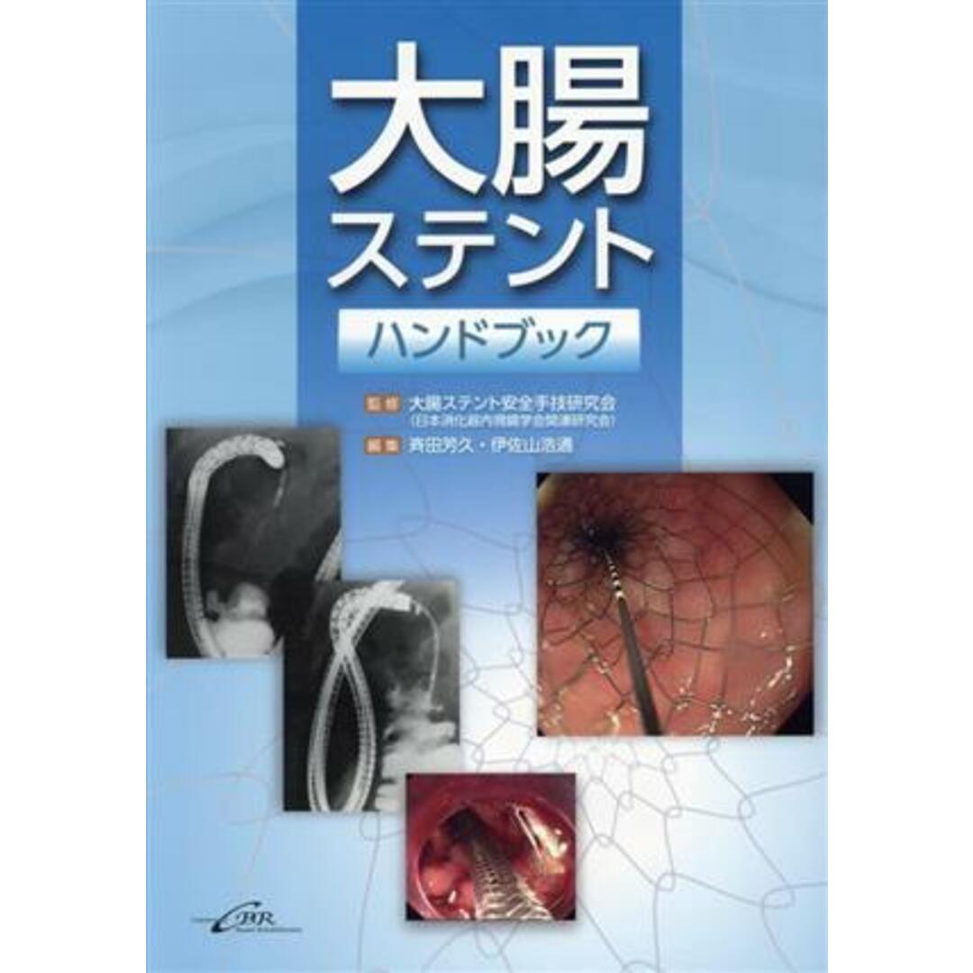 大腸ステントハンドブック/斉田芳久(編者),伊佐山浩通(編者),大腸ステント安全手技研究会(監修) エンタメ/ホビーの本(健康/医学)の商品写真