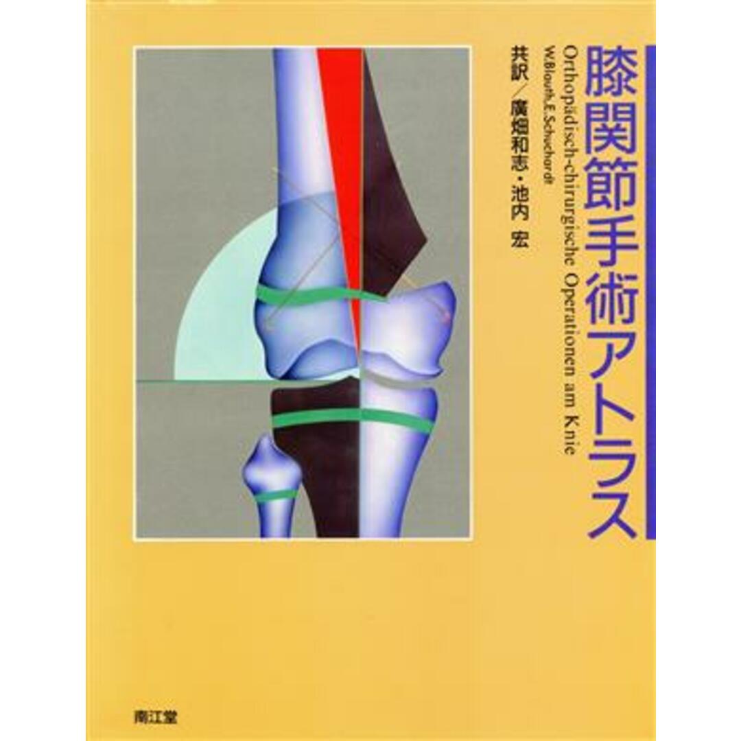 【超目玉枠】 膝関節手術アトラス/WalterBlauth,ErnstSchuchardt【著】,広畑和志,池内宏【共訳】 健康+医学
