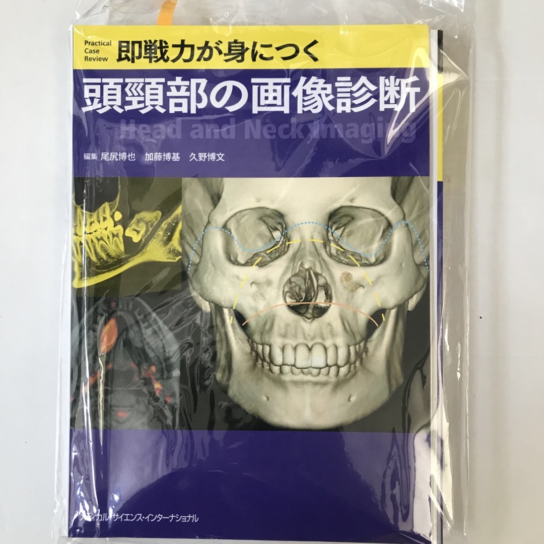 【裁断済】即戦力が身につく頭頸部の画像診断 エンタメ/ホビーの本(健康/医学)の商品写真
