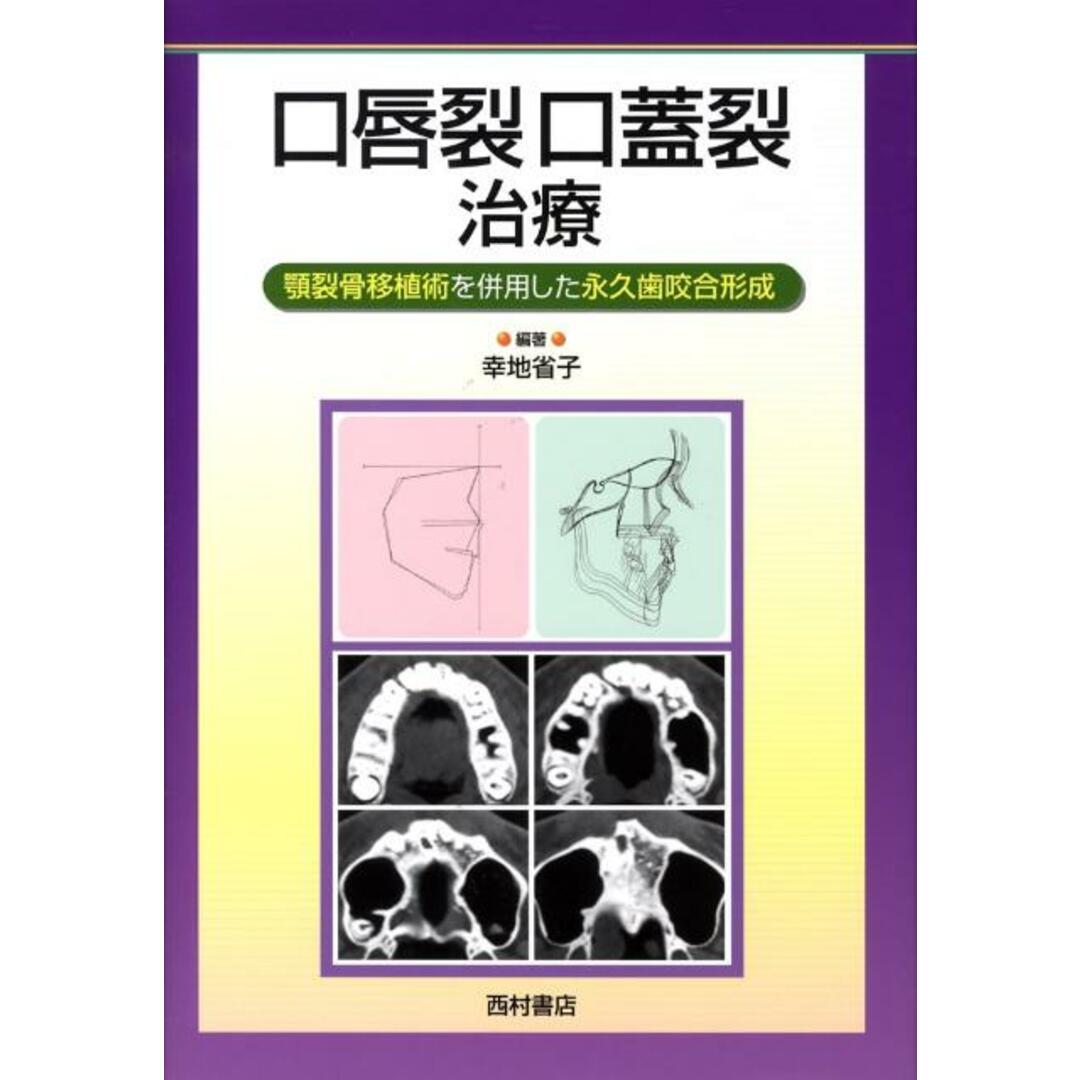 入荷now 口コミ 口唇裂口蓋裂治療 顎裂骨移植術を併用した永久歯咬合形成/西村書店(新潟)/幸地省子(大型本) 健康+医学
