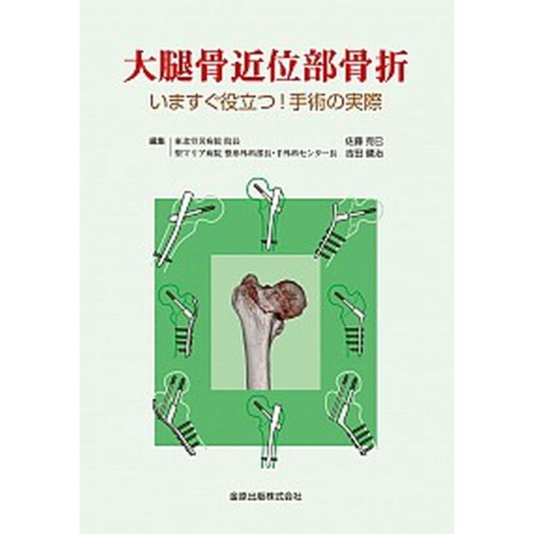 大腿骨近位部骨折 いますぐ役立つ!手術の実際 /金原出版/佐藤克巳(単行本) エンタメ/ホビーの本(健康/医学)の商品写真