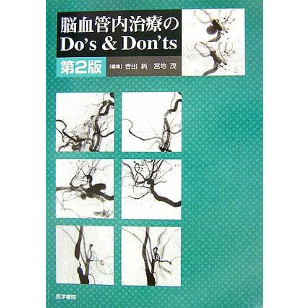 脳血管内治療のDo’s&Don’ts 第2版 エンタメ/ホビーの本(語学/参考書)の商品写真