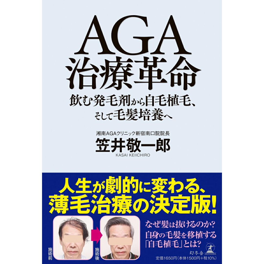 AGA治療革命 飲む発毛剤から自毛植毛、そして毛髪培養へ/幻冬舎/笠井敬一郎(単行本) エンタメ/ホビーの本(健康/医学)の商品写真