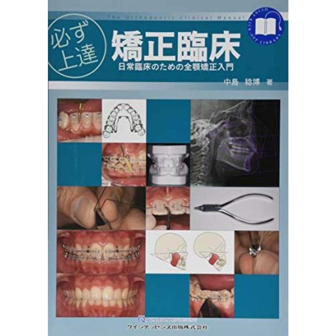 必ず上達 矯正臨床 (必ず上達シリーズ) エンタメ/ホビーの本(語学/参考書)の商品写真