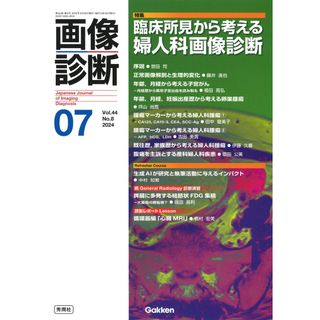 画像診断 ２０２４年７月号Ｖｏｌ．４４Ｎ/Ｇａｋｋｅｎ（単行本）(健康/医学)